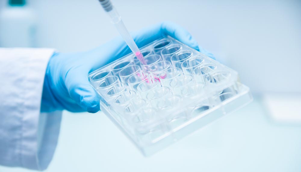 Biomarkers - mechanism of resistance